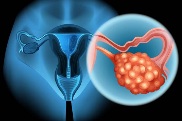 Best Gynecologic Oncologist in Hyderabad