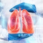 Lung Cancer Surgeon in Hyderabad