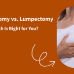 Mastectomy vs Lumpectomy – Breast cancer surgery options explained
