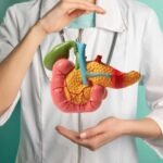 Doctor holding pancreas model highlighting the importance of multidisciplinary care in HPB cancers