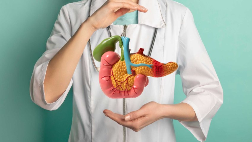 Doctor holding pancreas model highlighting the importance of multidisciplinary care in HPB cancers