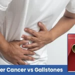 Man holding his abdomen showing pain — illustration comparing Gallbladder Cancer vs Gallstones.