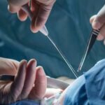 Surgeons performing Breast Cancer Surgery in an operating room to remove cancerous tissue.