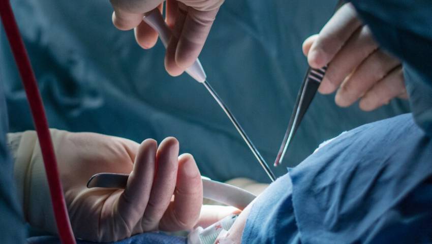 What Is Breast Cancer Surgery? A Complete Guide for Patients