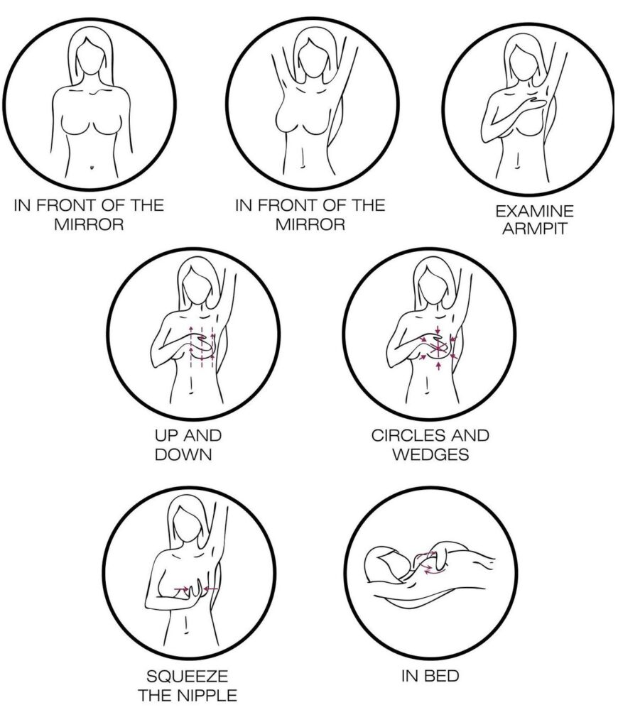 An educational infographic showing Steps for Breast Self-Exam with detailed breast self exam images. The diagram includes pictures of self breast examination techniques such as visual inspection in front of a mirror, examining the armpit, using circular and up-and-down motions, squeezing the nipple for discharge, and performing a breast test while lying in bed.