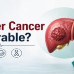 3D medical illustration of liver with cancerous tumour asking Is Liver Cancer Curable — expert liver cancer treatment by Dr. MSS Keerthi, Liver Cancer Surgeon at Hills Onco Care, Hyderabad